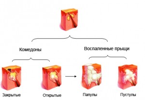 Догляд за проблемною шкірою